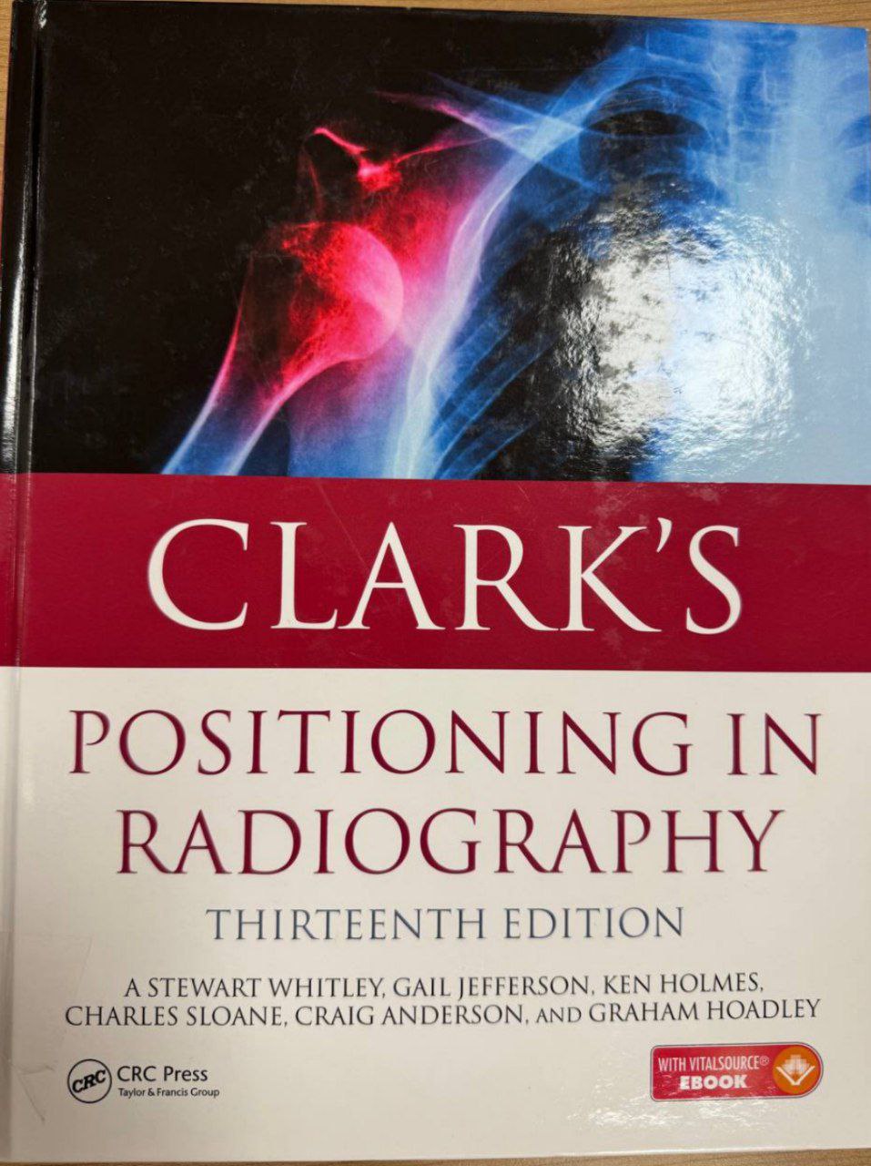 بالتعاون مع المكتبة المركزية قسم تقنيات الاشعة يوفر مصادر علمية لطالباته